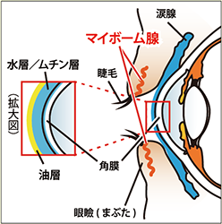 マイボーム腺機能不全（MGD）・ドライアイに対する治療